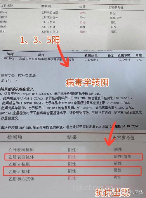 可实现乙肝表面抗原转阴