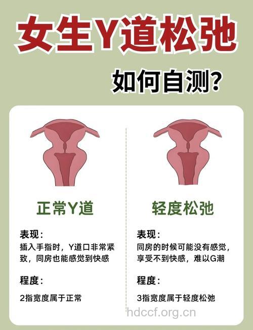 这个月你做了阴部自检吗？