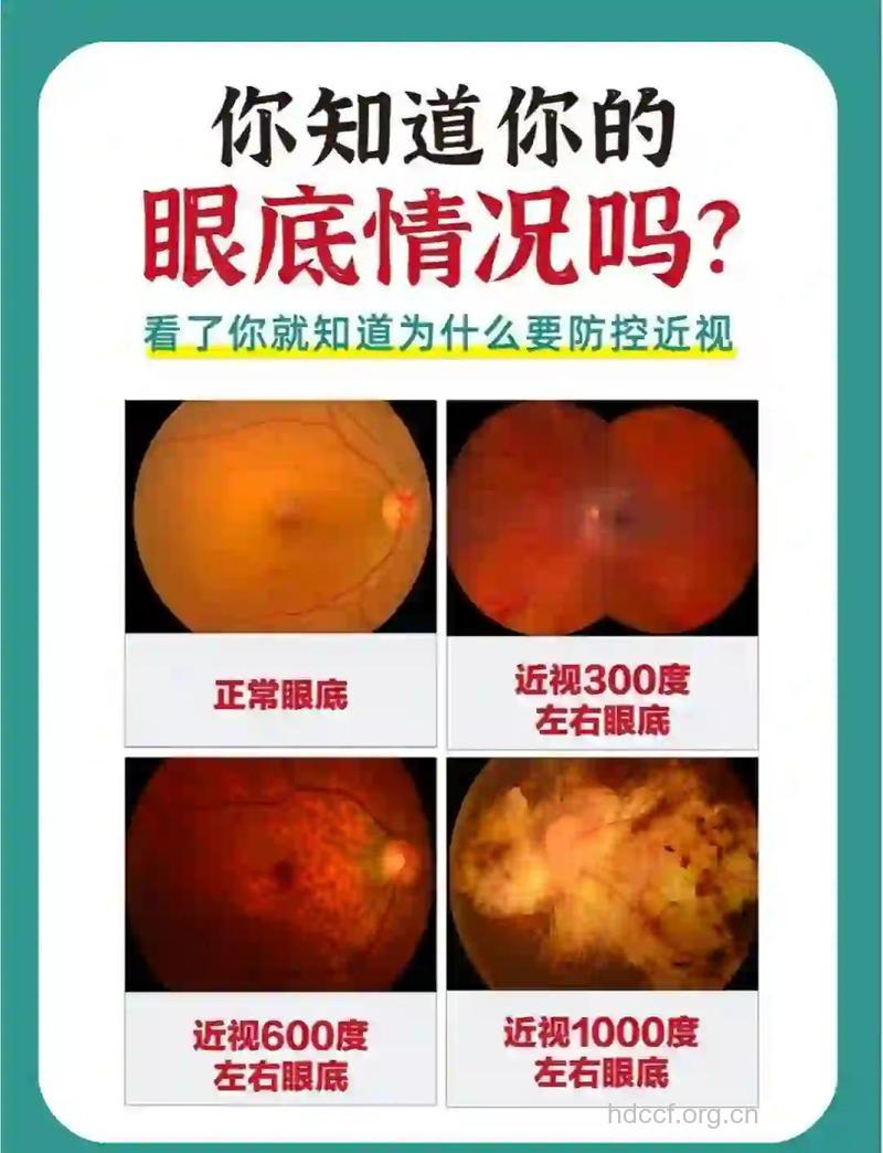 千万别忽视眼部检查！