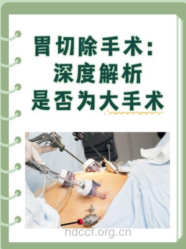 胃癌的姑息切除术能代替手术吗