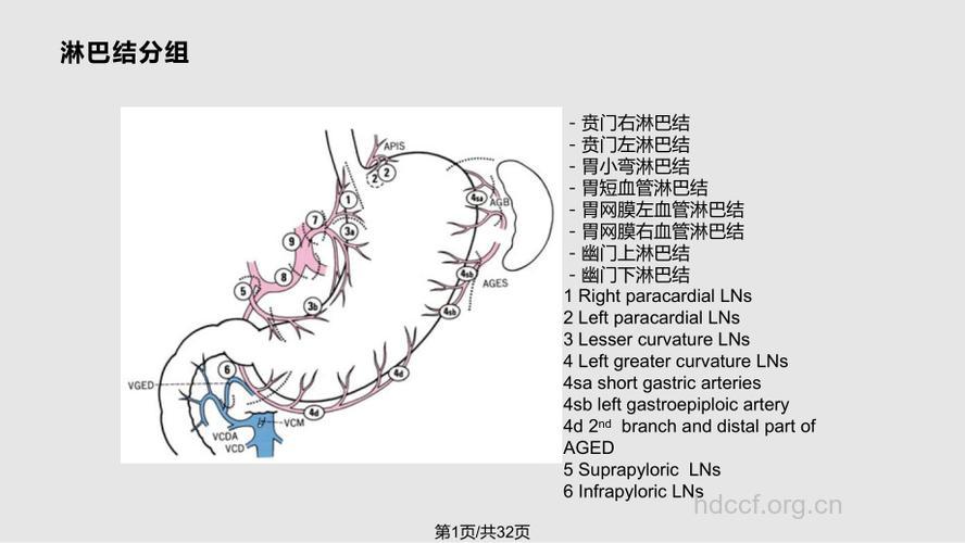 胃癌伴淋巴结转移症状和治疗