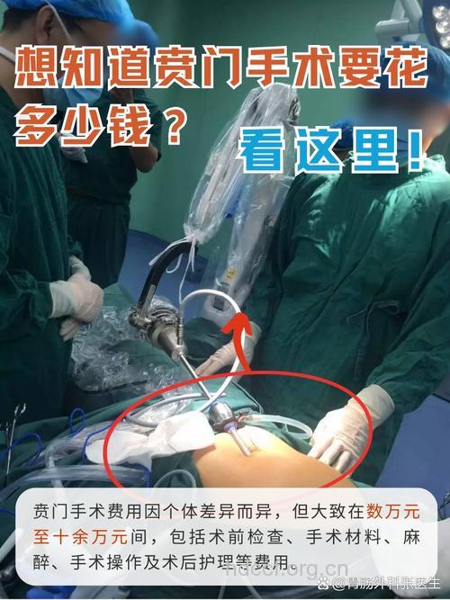 贲门癌采用何种手术方式?