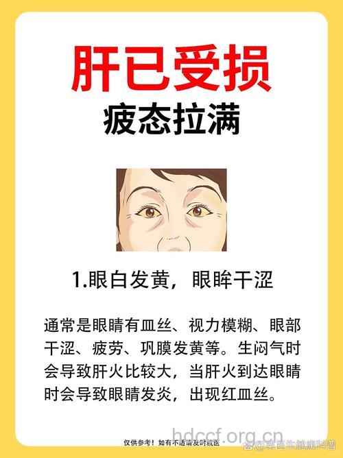 眼白发黄肝不好!如何养肝明目