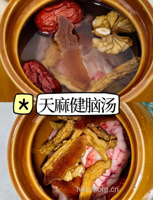 头痛怎么办 推荐天麻白芷炖猪脑汤