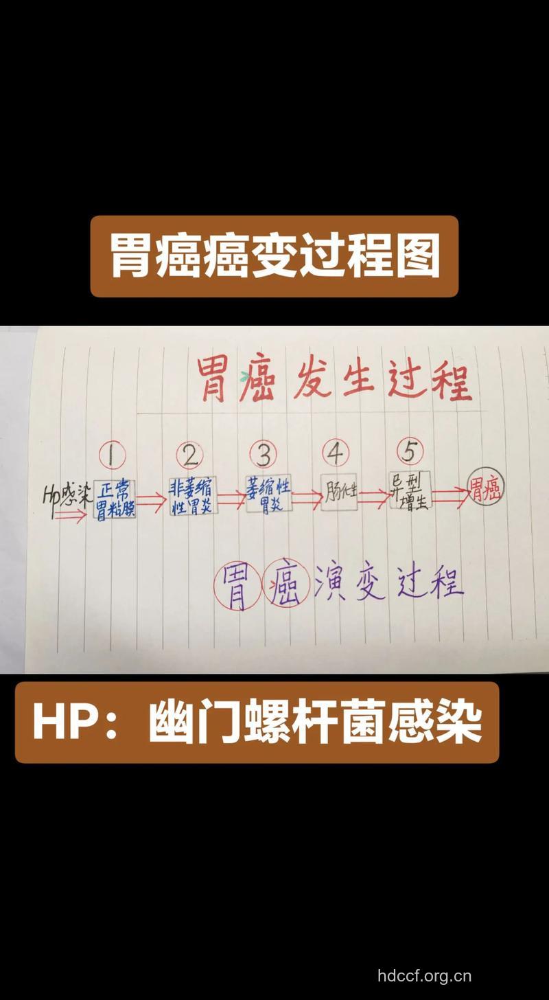 怎么观察胃癌病变的症状