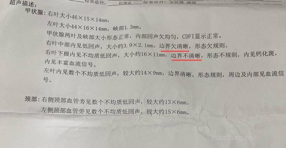 甲状腺检查要做B超？ 这些检查项目不能忽视