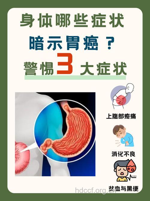 警惕胃癌多变的临床表现