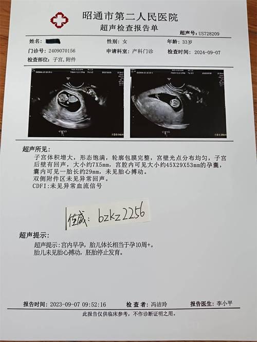 孕检B超最好要做几次