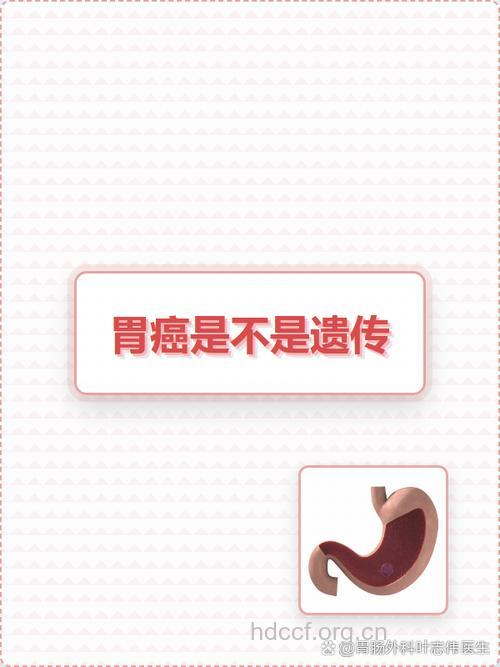 胃癌遗传性的正确认识