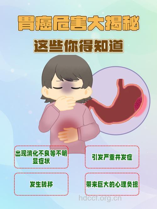 精神压力过大也可能引发胃癌