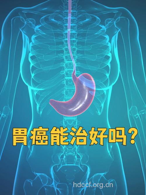 治胃癌来试试中医
