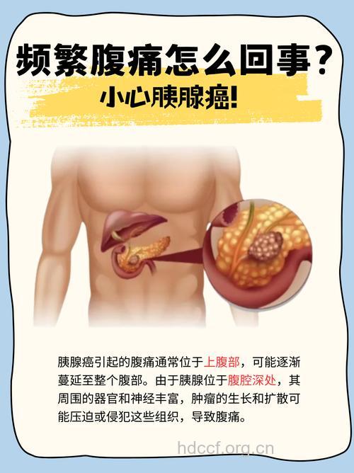 胰腺癌早期症状 不可忽视腹痛症状