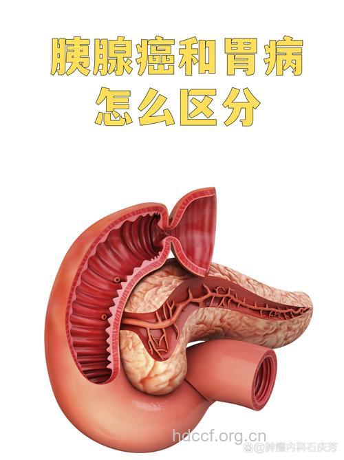 胰腺癌与肝病胃病区分