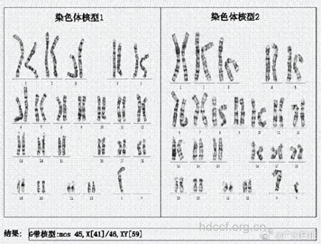 性染色体检查的类型