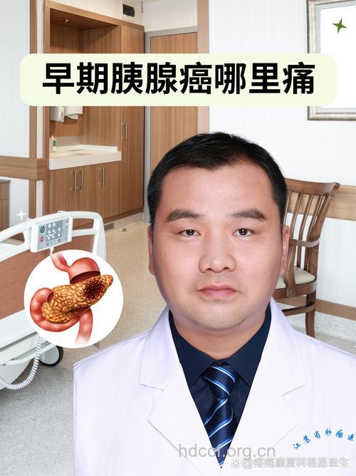 胰腺癌 真的喜欢盯胖子吗