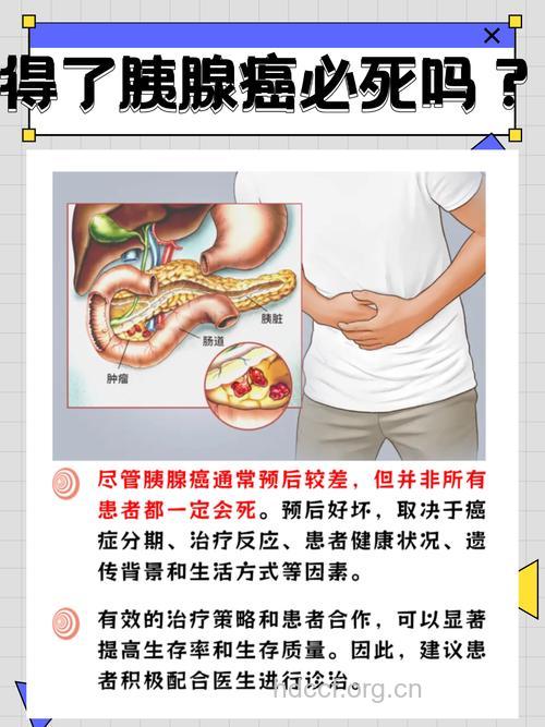 胰腺癌的存活率有多高