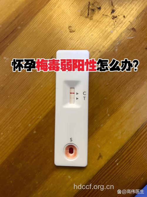 孕妇需要的性病检测