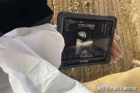 孕期B超检查有哪些作用?