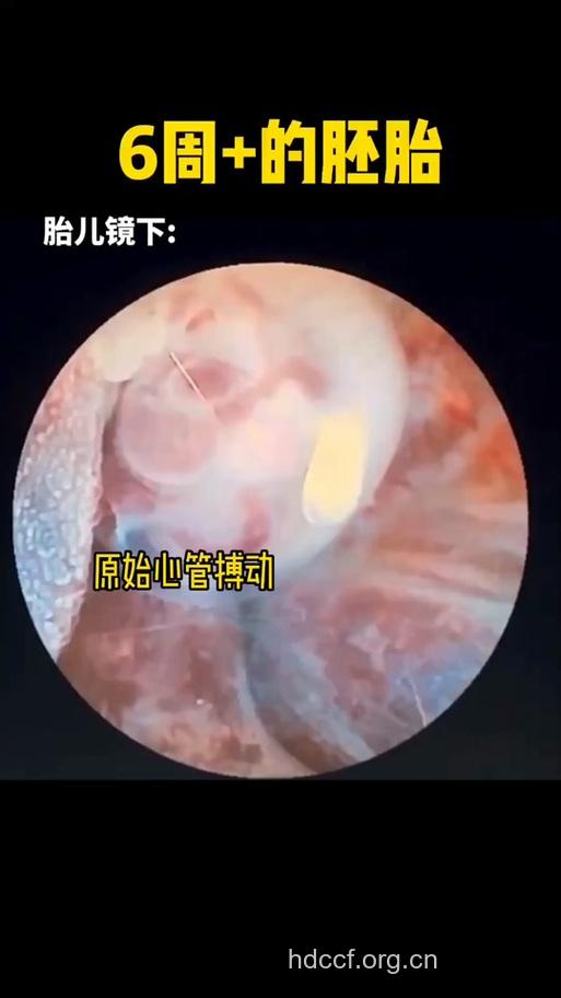 胎儿镜帮你知道胎宝宝情况