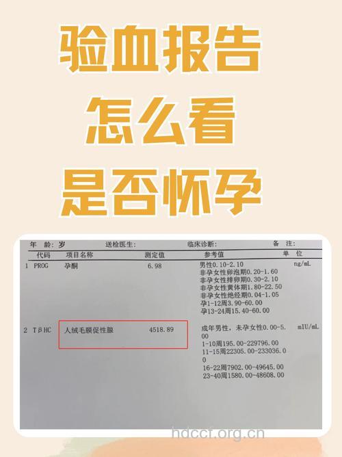 孕前需要做血铅含量检查吗？