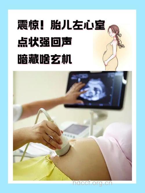 产前超声检查并不是火眼金睛