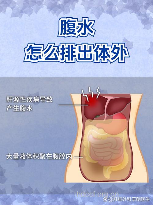 怎么进行胰腺癌腹水处理