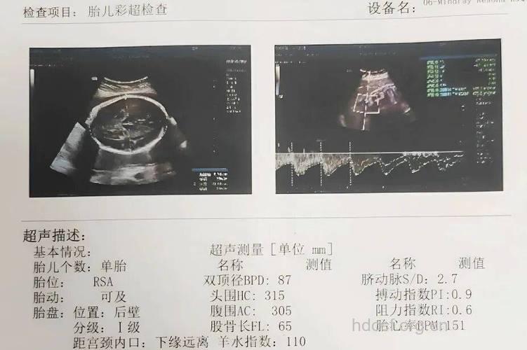 孕期B超不宜超过三次