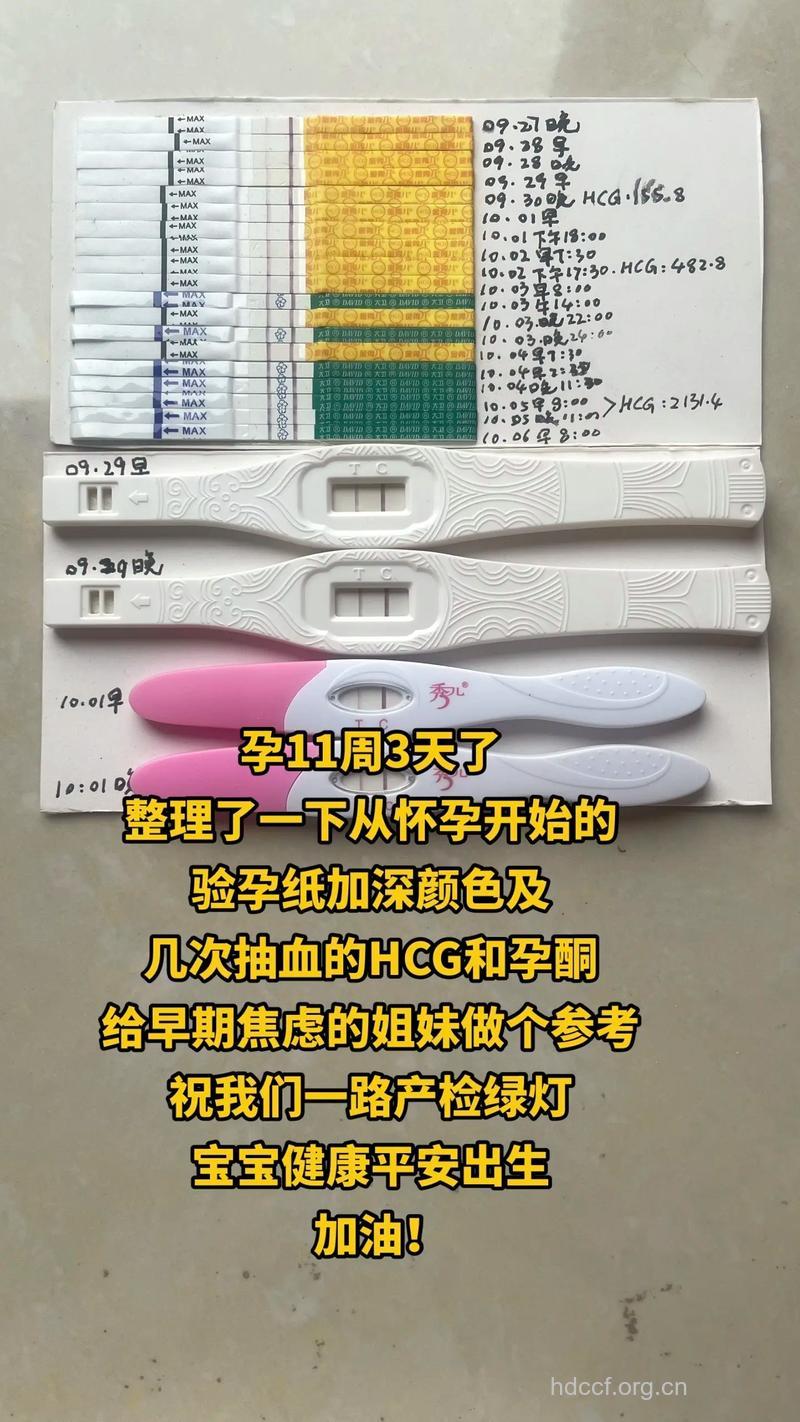 HCG可以测出宫外孕吗?