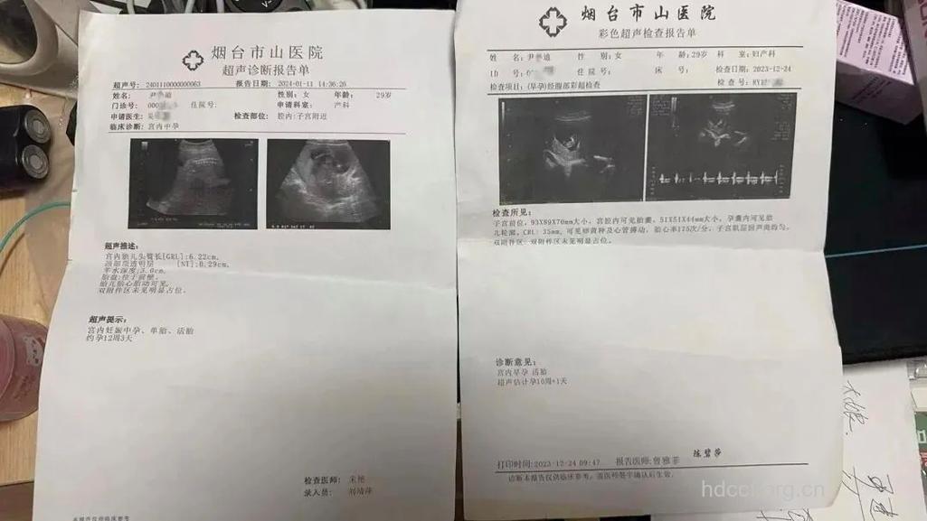 孕妇B超不是什么病都能查