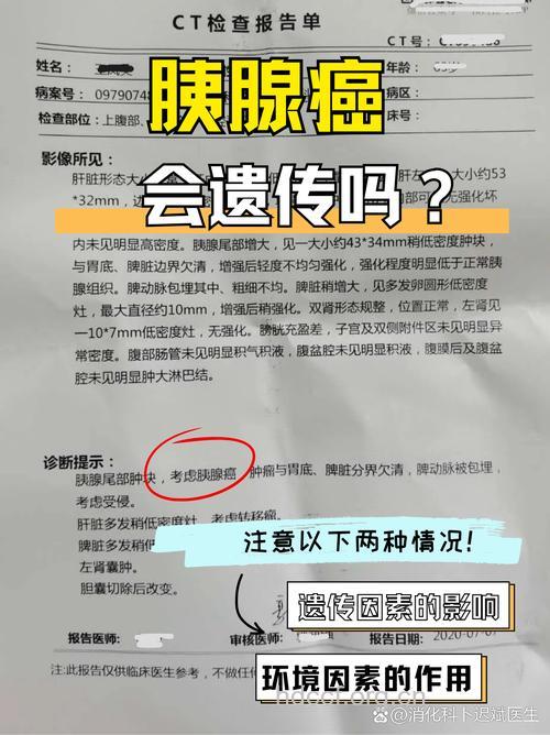 胰腺癌是否可以遗传呢