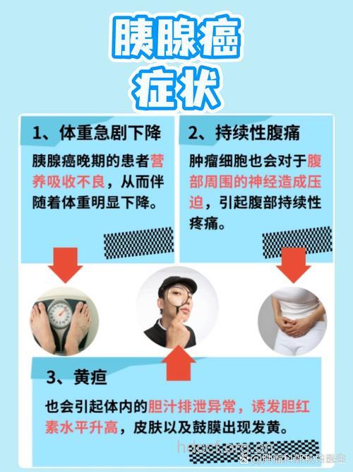 胰腺癌早期的几个明显症状