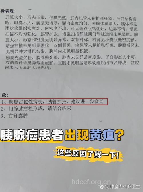 胰腺癌的表现是出现黄疸吗