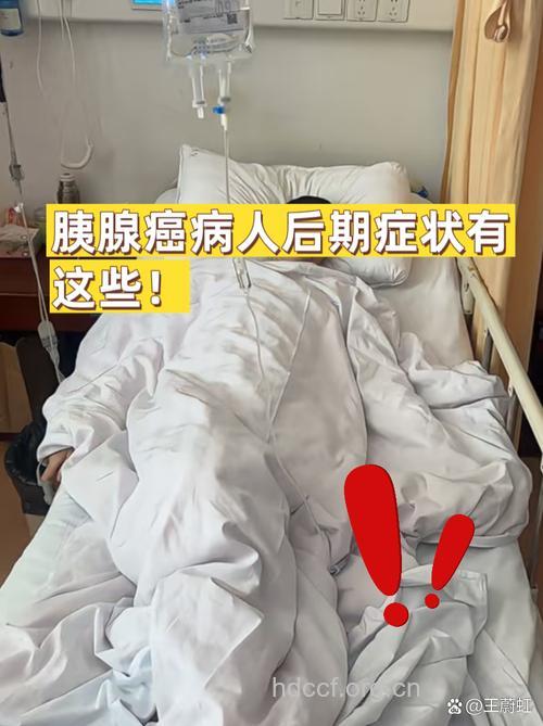 胰腺癌晚期的症状