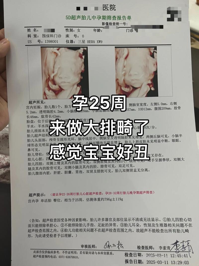 育龄妇女孕前需做排畸形检查!