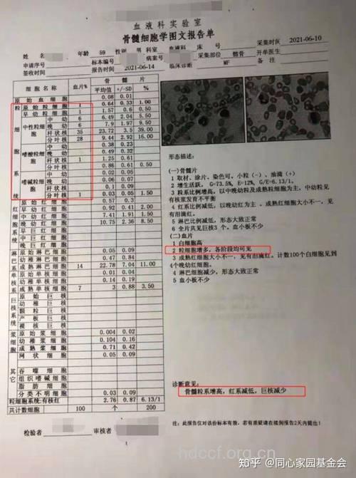如何看骨髓穿刺报告单