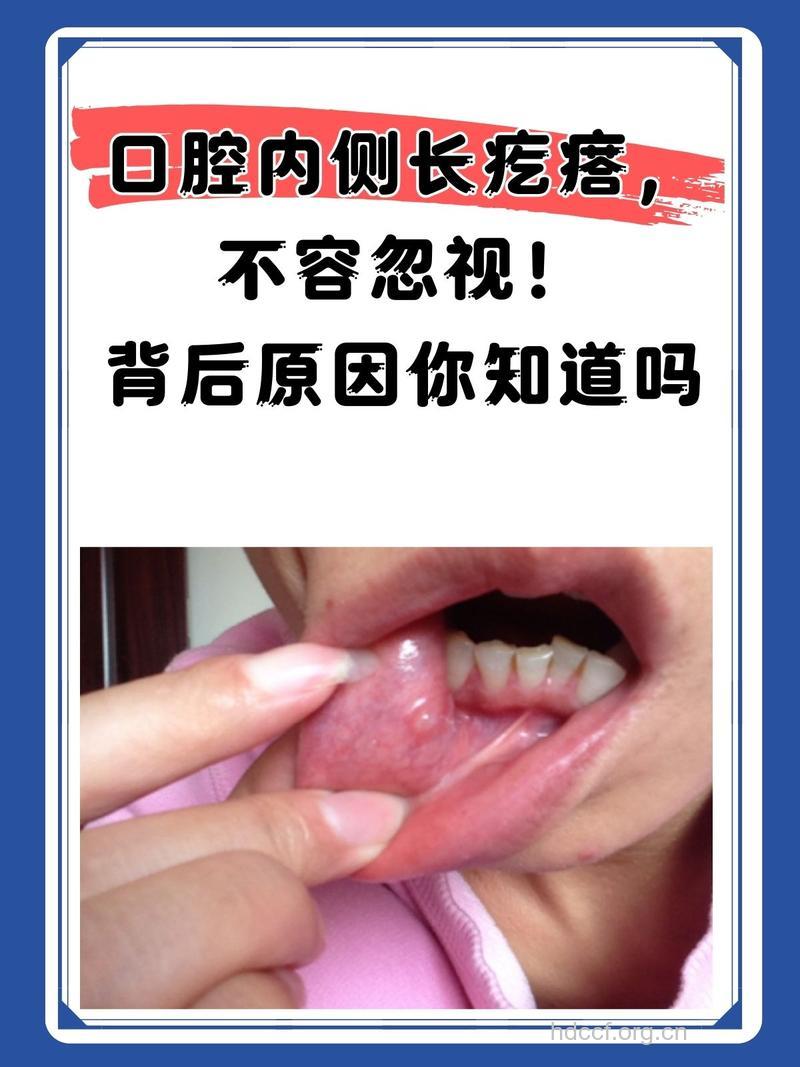 口腔有腐味或肝病征兆