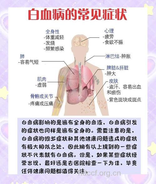 急性淋巴细胞白血病有哪些临床表现