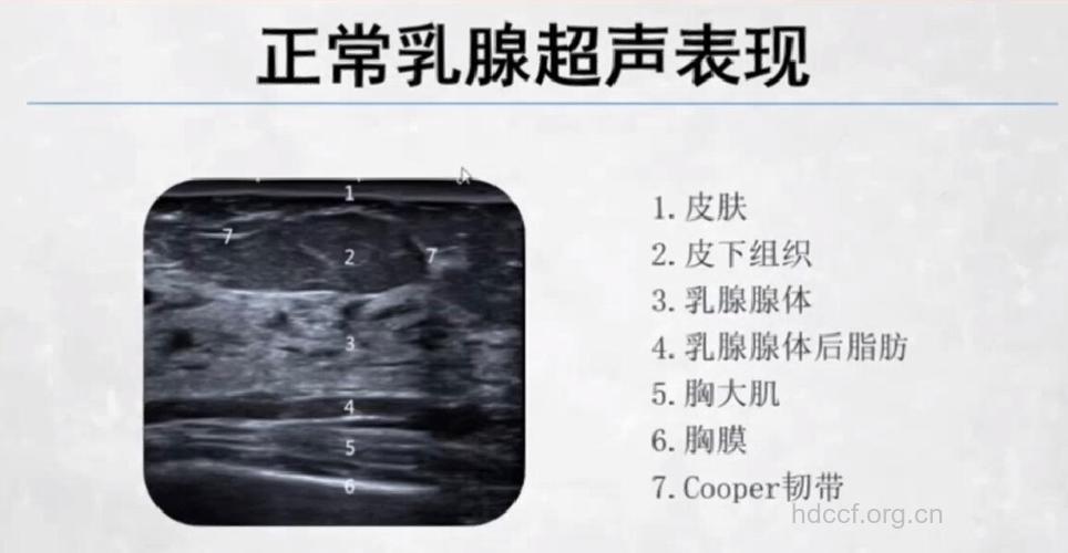 大多数人乳腺检查：彩超最合适