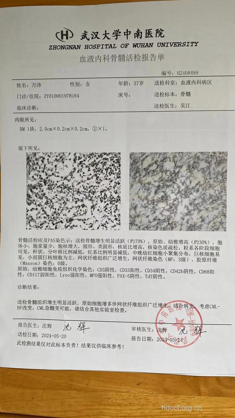 慢性粒细胞白血病做何检查