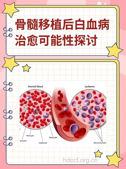 骨髓移植—白血病治疗的福音