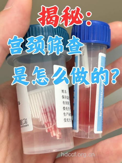 关于宫颈糜烂有什么检测手段