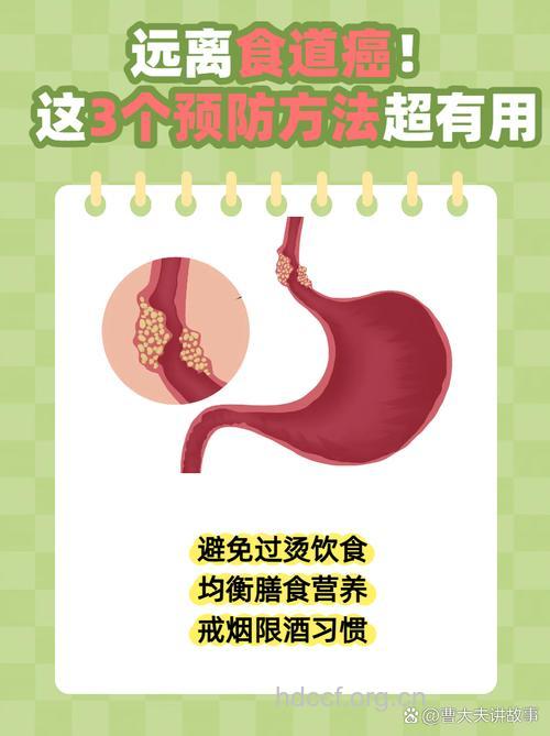 食道癌的三大预防原则