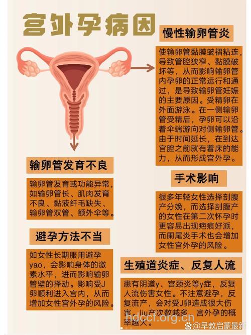 女性导致宫外孕的原因