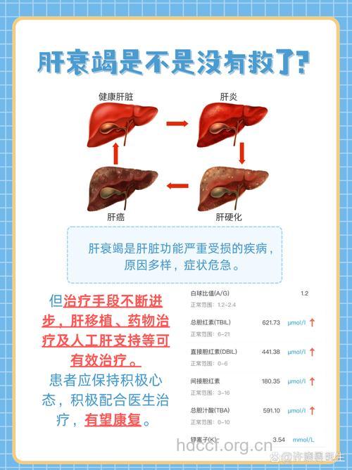 疾病百科 什么是急性肝衰竭呢