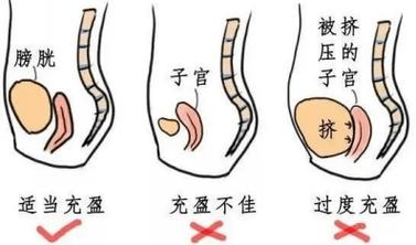 妇科B超为什么要憋尿