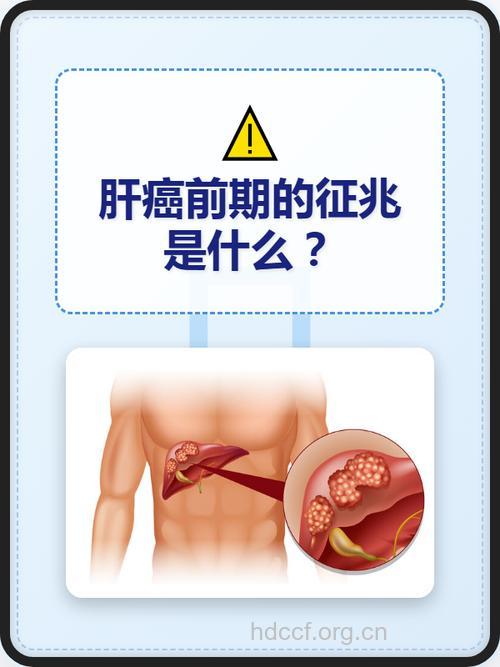 突然消瘦无力？赶紧去医院检查是否患上肝癌