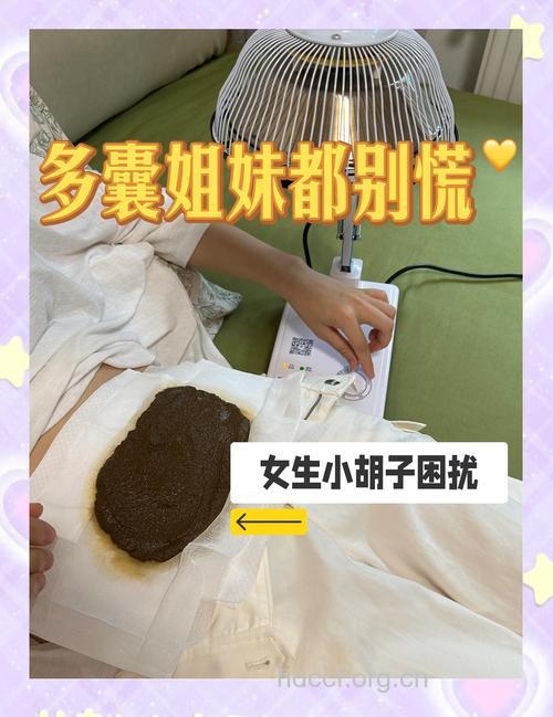 女人也会长胡子?多囊卵巢疾病作祟