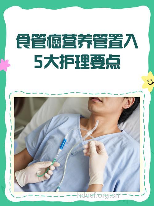 治疗食道癌有哪些渠道