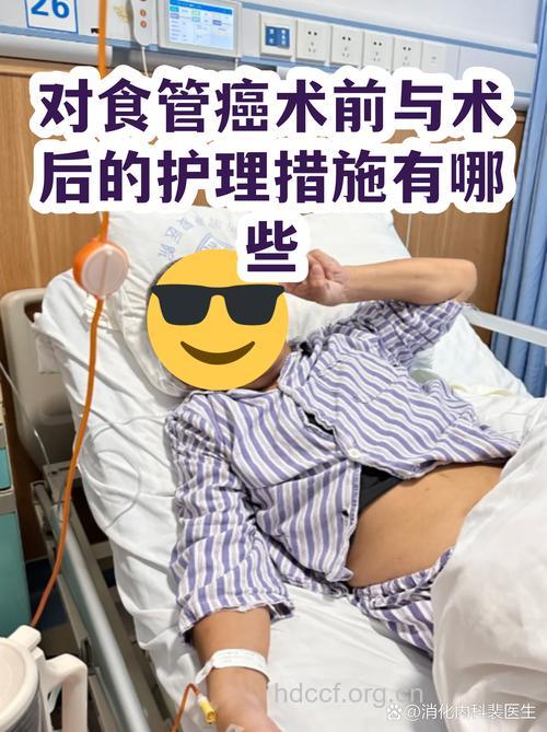食道癌患者术前需准备什么工作