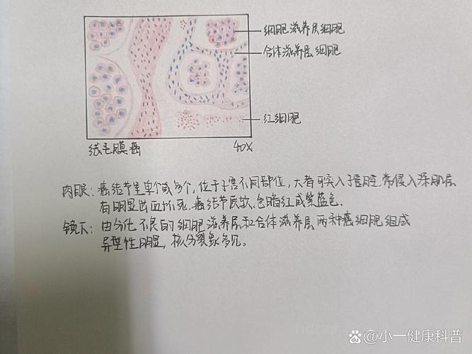 绒毛膜癌典型病例分析